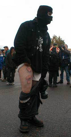 Anti-WTO protester in Seattle injured by police